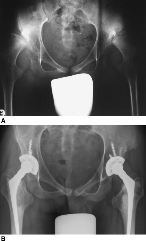 Fig. 1A–B