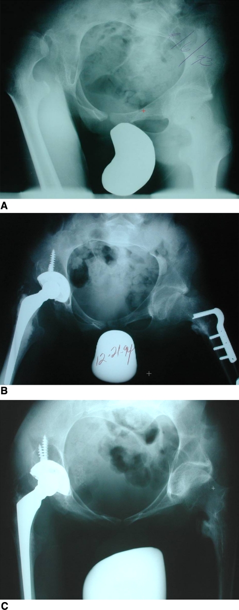 Fig. 4A–C