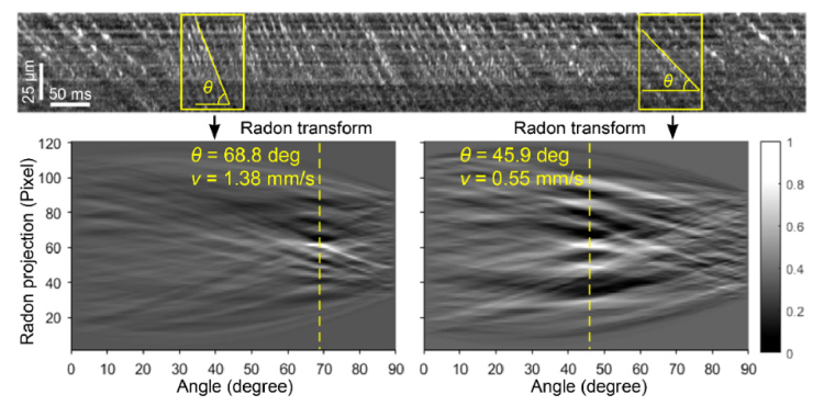 Fig. 12