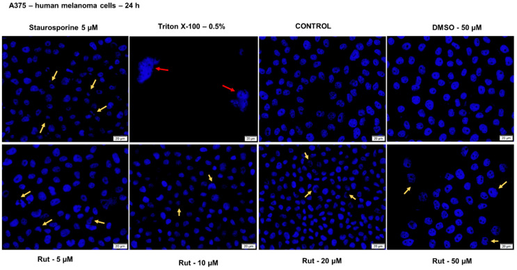 Figure 13