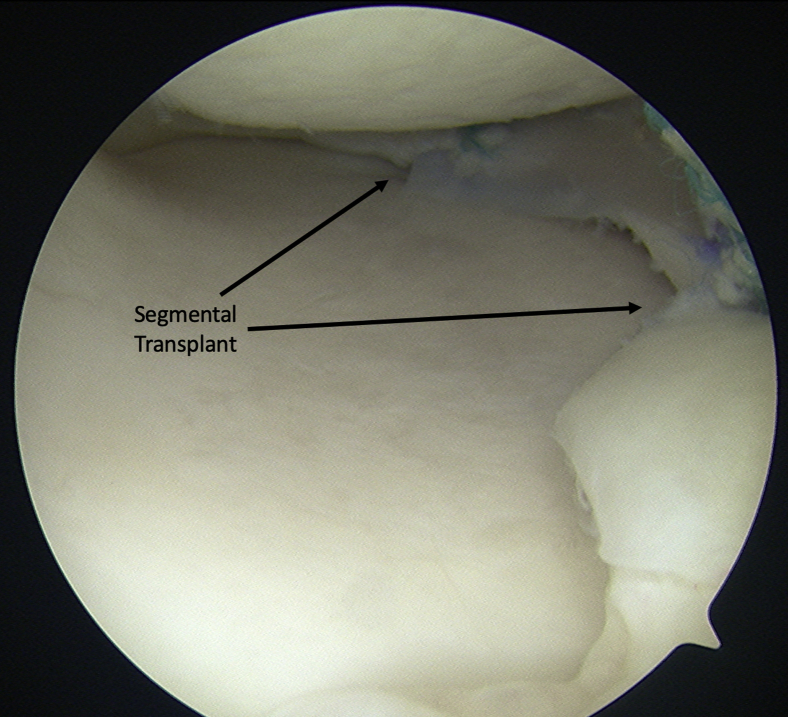 Fig 10