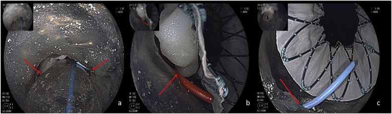 Fig. 1