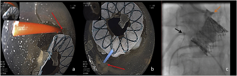 Fig. 2