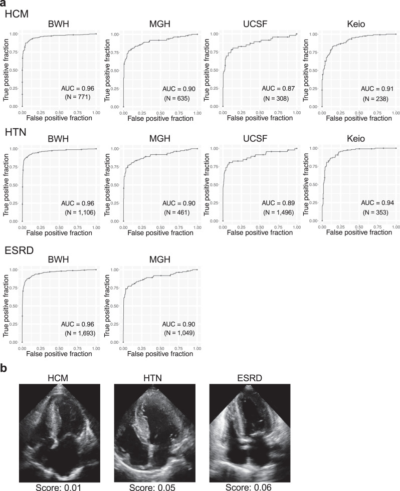 Artificial intelligence-enabled fully automated detection of cardiac ...