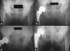 Figure 3B