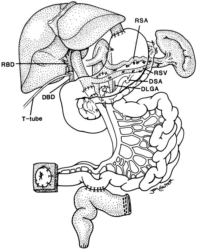 graphic file with name 14FF3.jpg