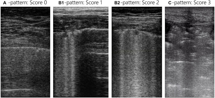 FIGURE 3