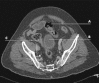 Fig. 1