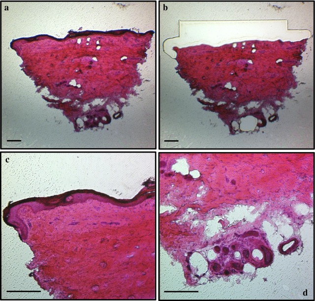 Fig. 1