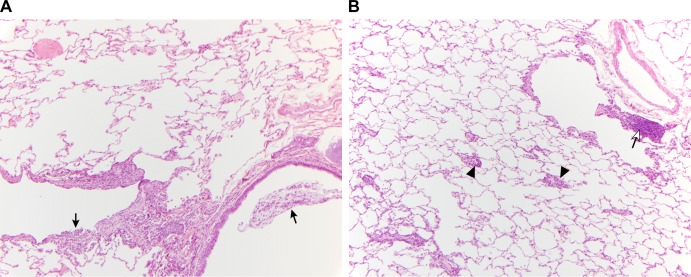 FIG 3