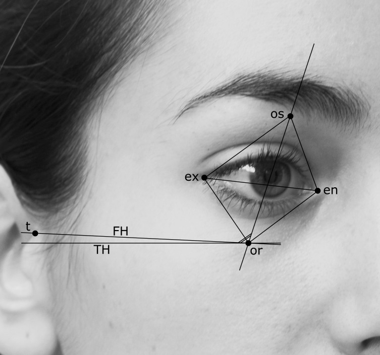 Figure 1. Three-dimensional soft tissue facial landmarks used in the current study, identified on an Italian 20-year-old woman: ex indicates exocanthion; en, endocanthion; os, orbitale superius; or, orbitale; t, tragion. Frankfurt plane (FH) and true horizontal (TH) are also traced.