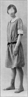 Fig. 43