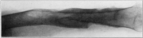 Fig. 55