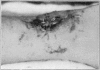 Fig. 13