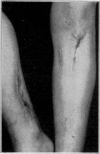 Fig. 19