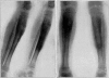 Fig. 38