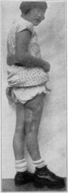 Fig. 46