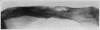 Fig. 54