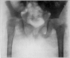 Fig. 21