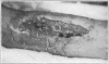 Fig. 12