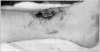 Fig. 44