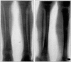 Fig. 18