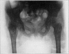 Fig. 22