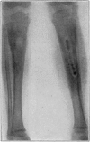 Fig. 37