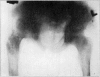 Fig. 32