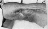 Fig. 53