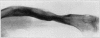 Fig. 56