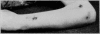 Fig. 49