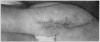 Fig. 35
