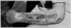 Fig. 51
