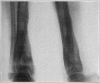 Fig. 42