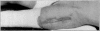 Fig. 25