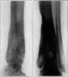 Fig. 41