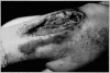 Fig. 23