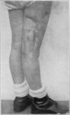 Fig. 45