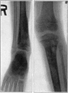Fig. 17