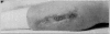 Fig. 24