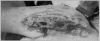 Fig. 34