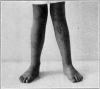 Fig. 40