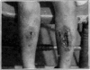 Fig. 39