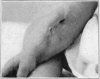 Fig. 31