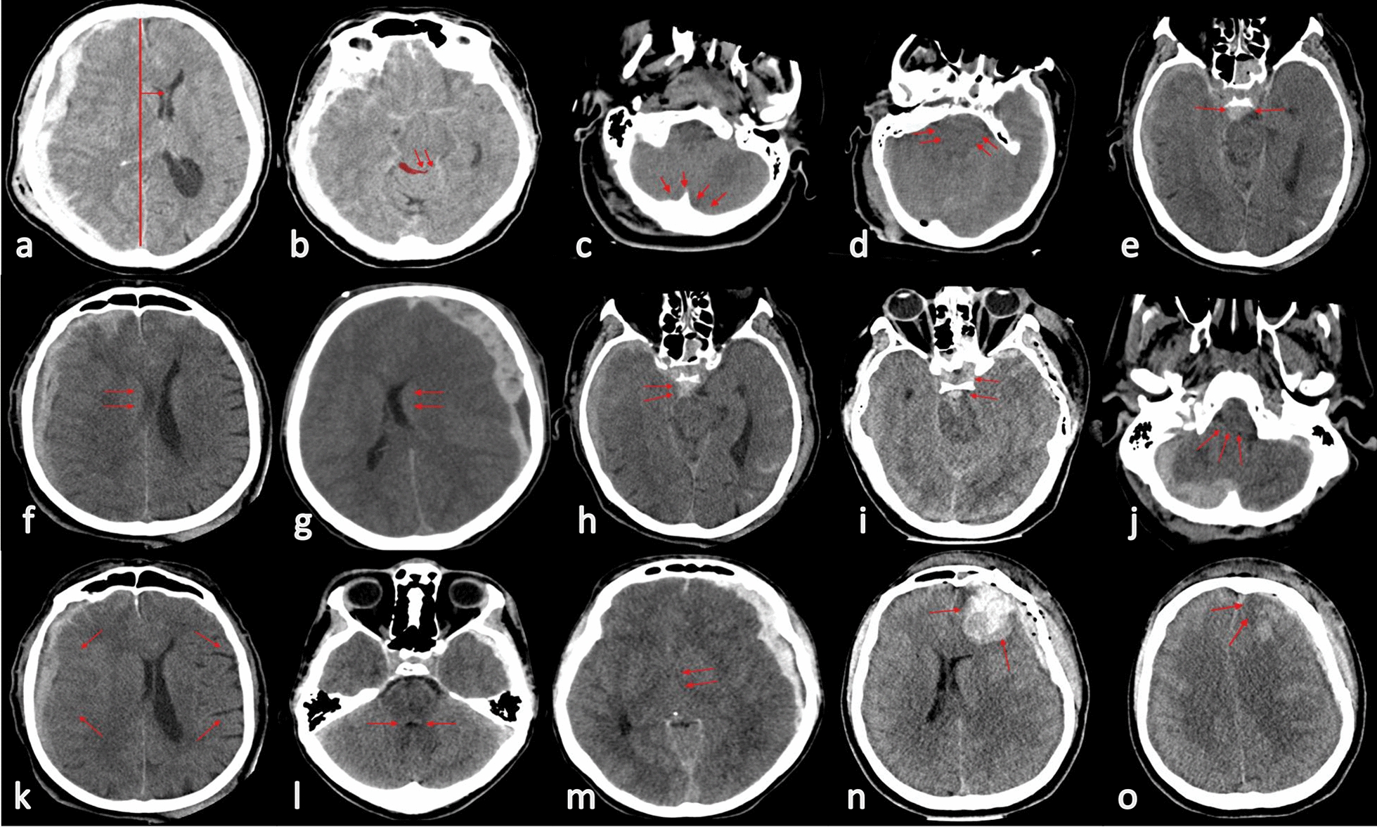 Fig. 1