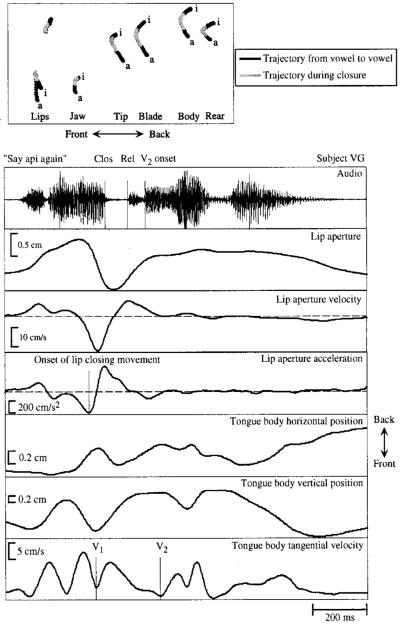 FIG. 1