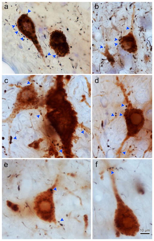 FIGURE 4