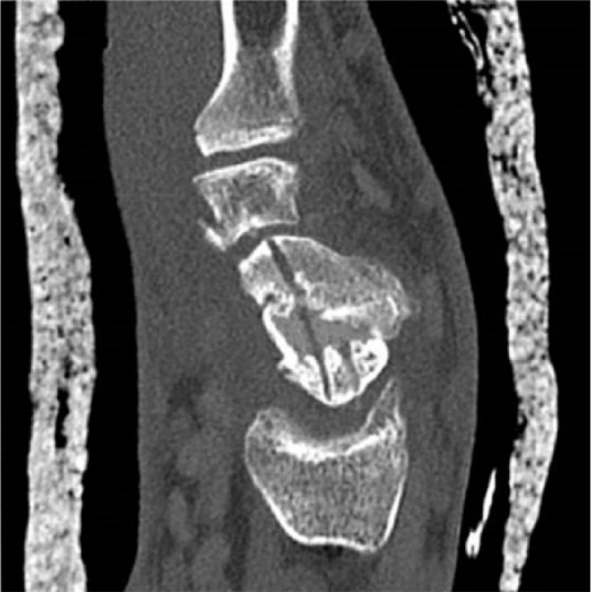 Fig. 1e