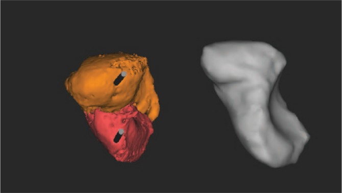 Fig. 1c